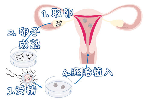 暖阳生殖医学中心